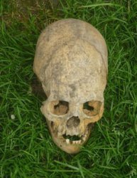 В Кабардино-Балкарии найдены захоронения длинноголовых людей